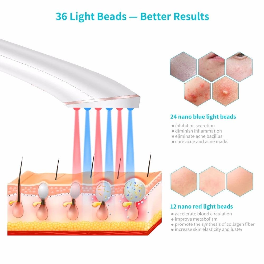 Acne Light Therapy Device